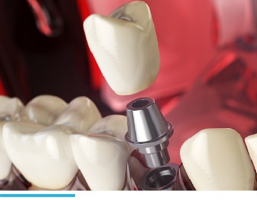 Стоматологическая клиника в Лазаревском